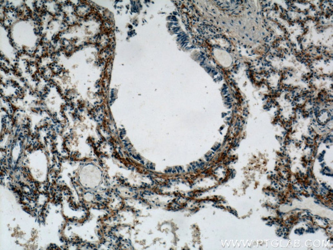 C5aR Antibody in Immunohistochemistry (Paraffin) (IHC (P))