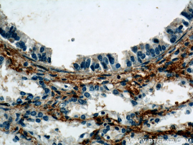 C5aR Antibody in Immunohistochemistry (Paraffin) (IHC (P))