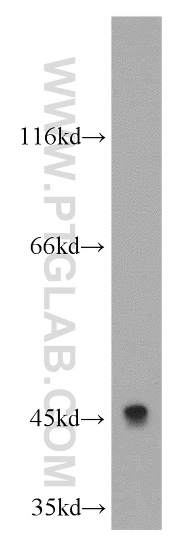 C5aR Antibody in Western Blot (WB)