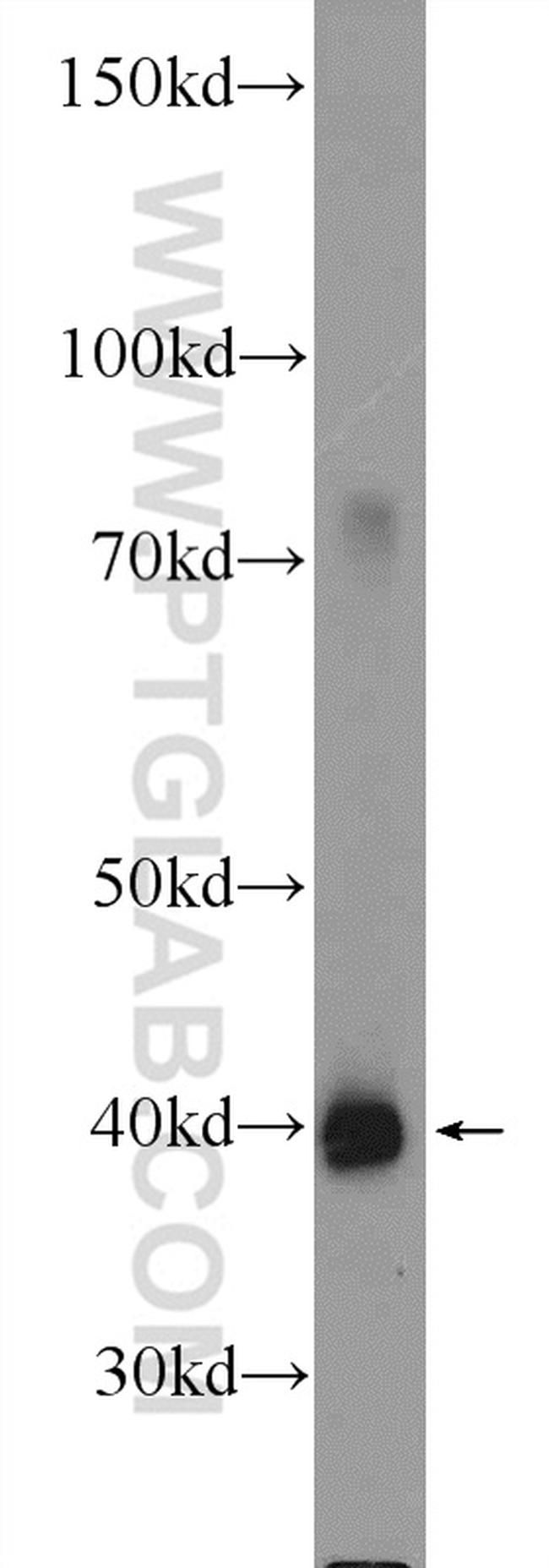 C5aR Antibody in Western Blot (WB)