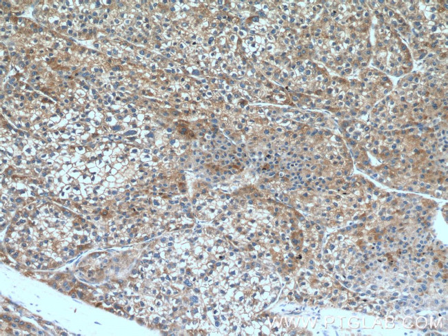 GTSE1 Antibody in Immunohistochemistry (Paraffin) (IHC (P))