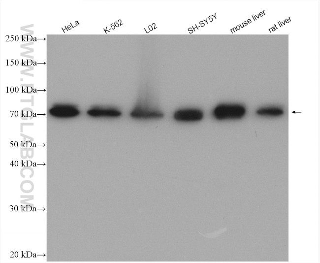 GTSE1 Antibody in Western Blot (WB)