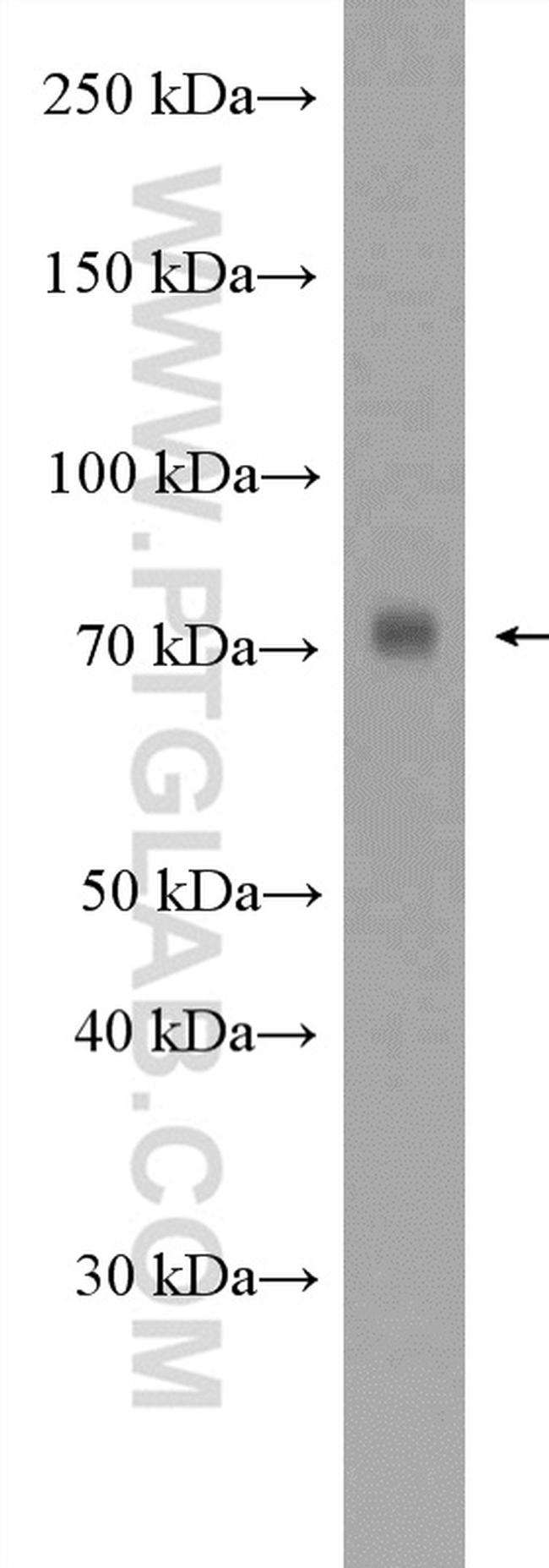 GTSE1 Antibody in Western Blot (WB)