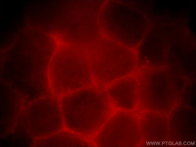 ZDHHC5 Antibody in Immunocytochemistry (ICC/IF)