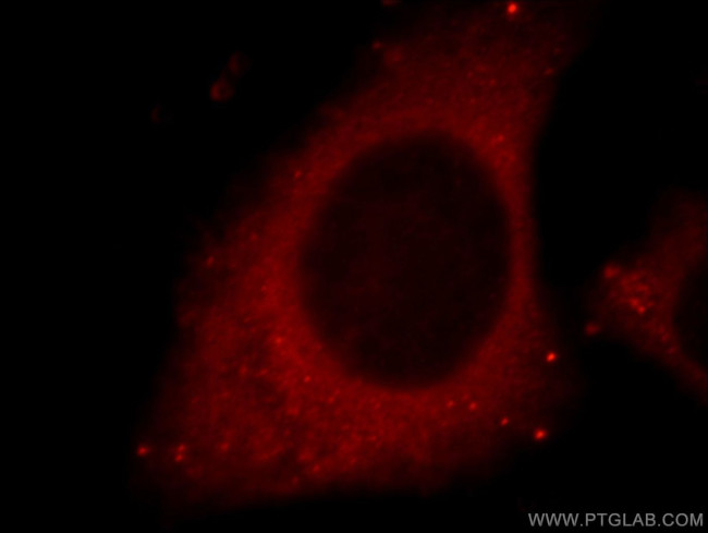 Cathepsin D Antibody in Immunocytochemistry (ICC/IF)