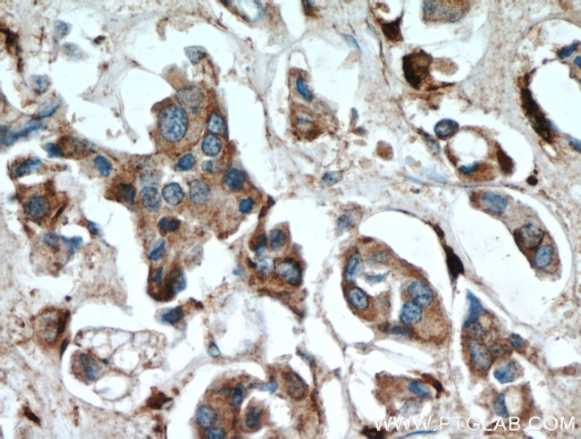 Cathepsin D Antibody in Immunohistochemistry (Paraffin) (IHC (P))