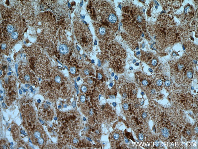 Cathepsin D Antibody in Immunohistochemistry (Paraffin) (IHC (P))