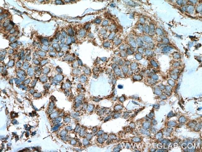 Cathepsin D Antibody in Immunohistochemistry (Paraffin) (IHC (P))