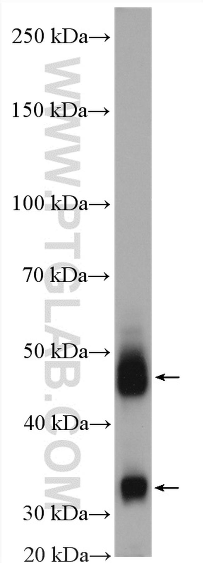 Cathepsin D Antibody in Western Blot (WB)