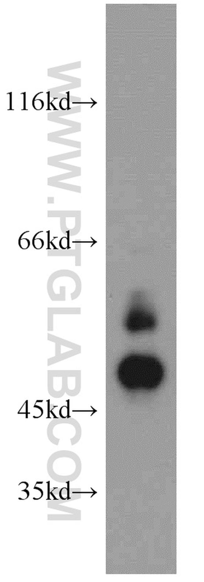 Cathepsin D Antibody in Western Blot (WB)