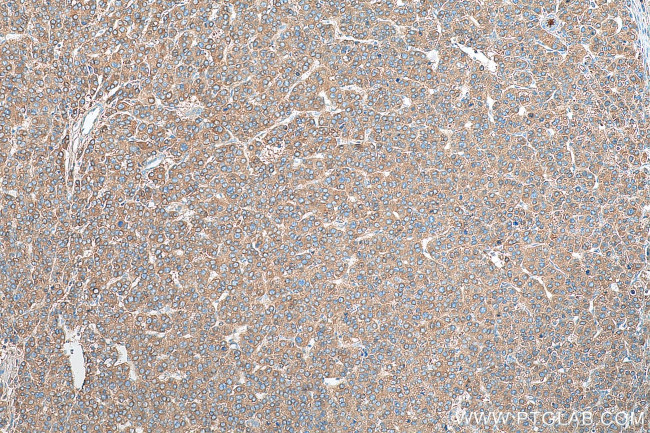 C3/C3b/C3c Antibody in Immunohistochemistry (Paraffin) (IHC (P))