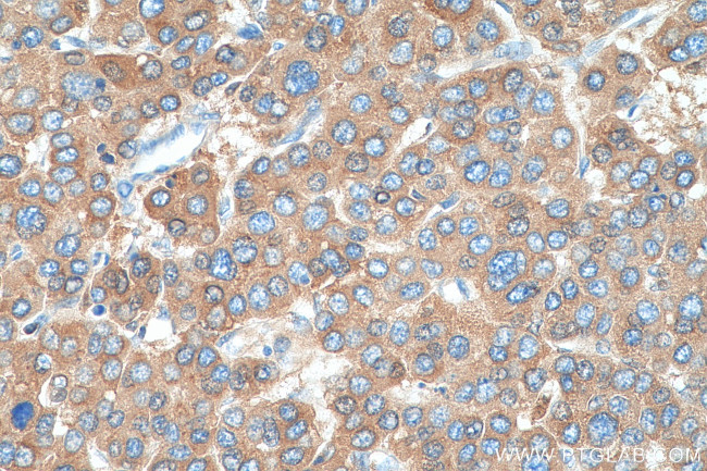 C3/C3b/C3c Antibody in Immunohistochemistry (Paraffin) (IHC (P))