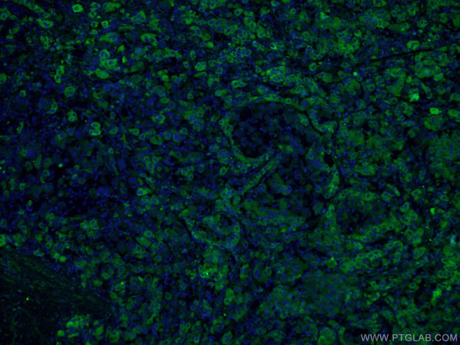 C3/C3b/C3c Antibody in Immunohistochemistry (PFA fixed) (IHC (PFA))