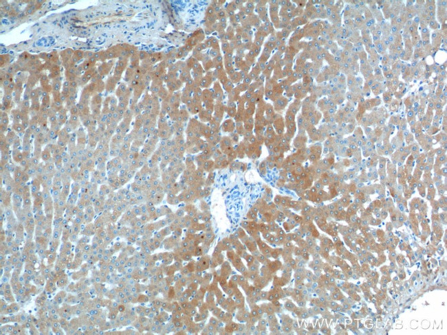 C3/C3b/C3c Antibody in Immunohistochemistry (Paraffin) (IHC (P))