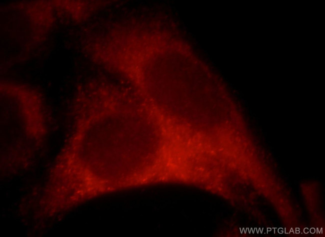 Sestrin 2 Antibody in Immunocytochemistry (ICC/IF)