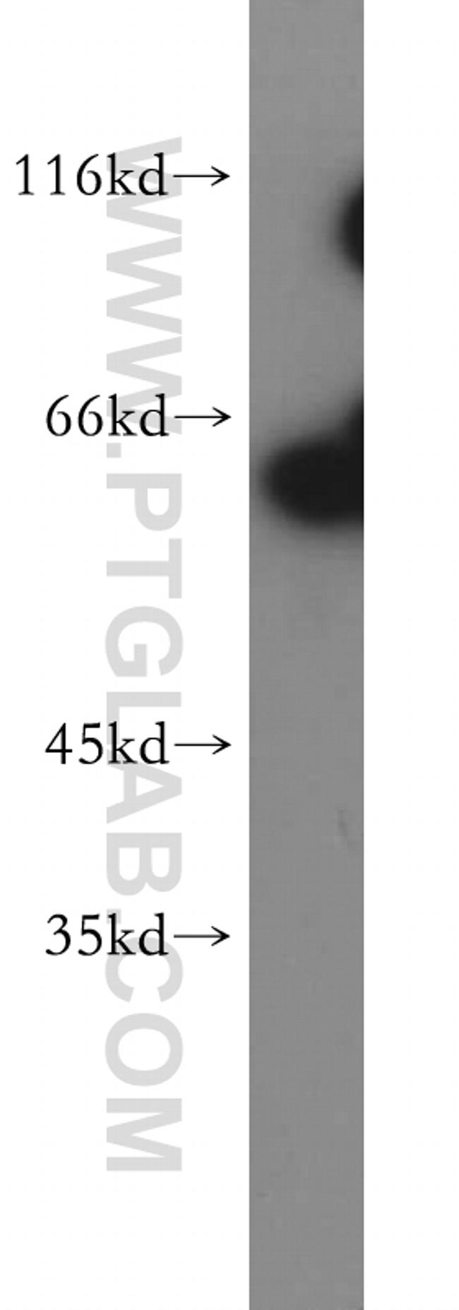 Sestrin 2 Antibody in Western Blot (WB)