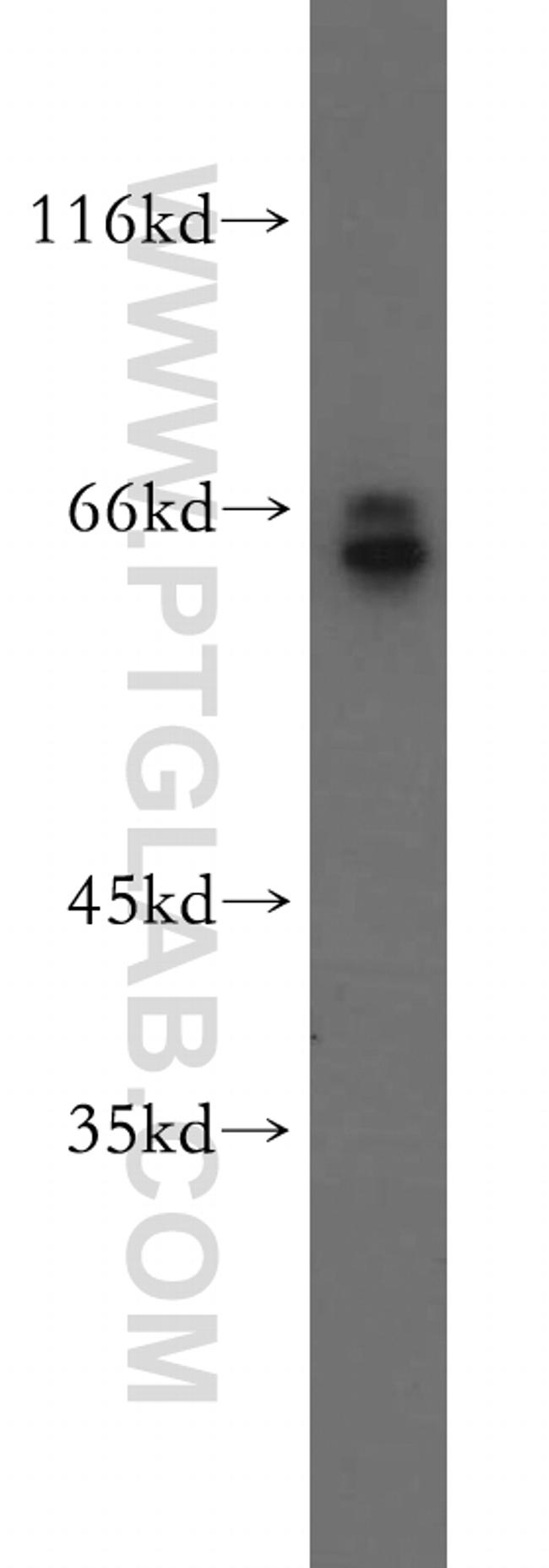 Sestrin 2 Antibody in Western Blot (WB)