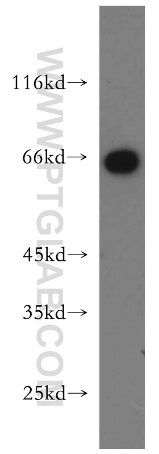 Sestrin 2 Antibody in Western Blot (WB)