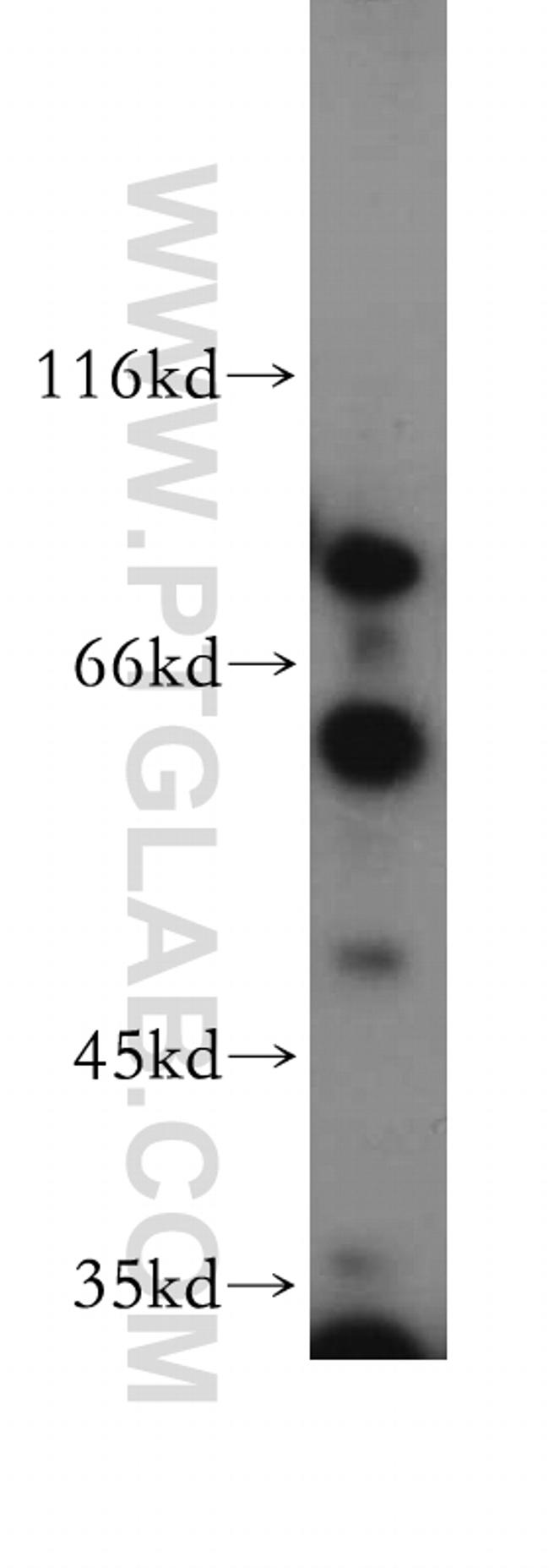 Sestrin 2 Antibody in Western Blot (WB)