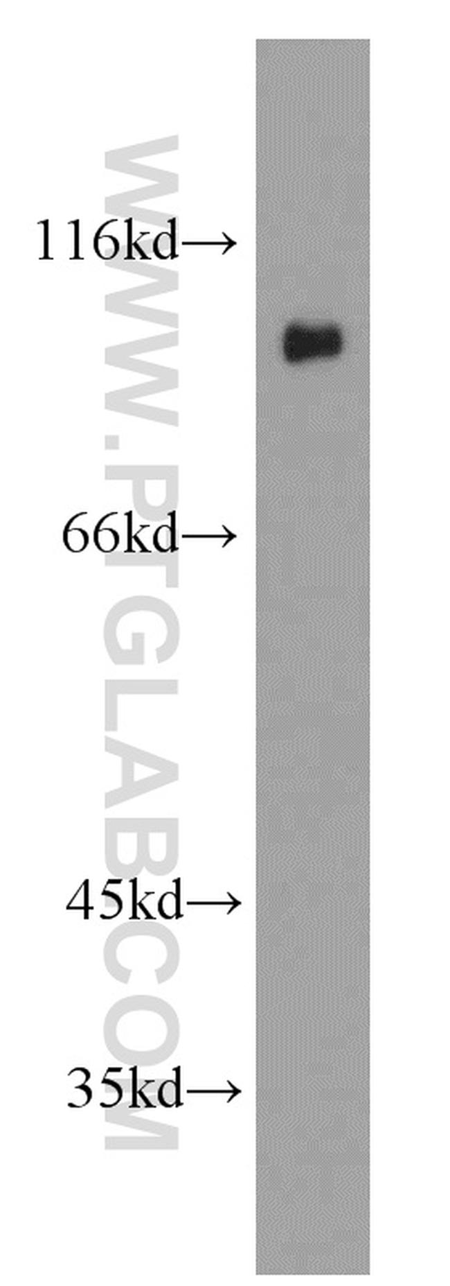 C21orf66 Antibody in Western Blot (WB)