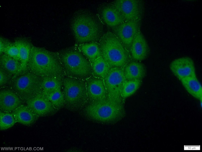 Cingulin Antibody in Immunocytochemistry (ICC/IF)