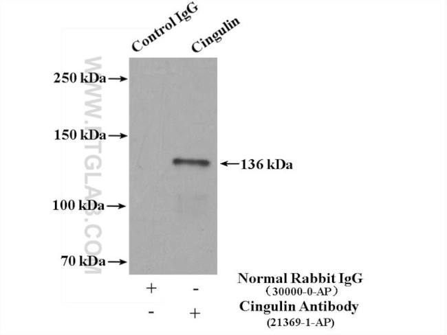 Cingulin Antibody in Immunoprecipitation (IP)