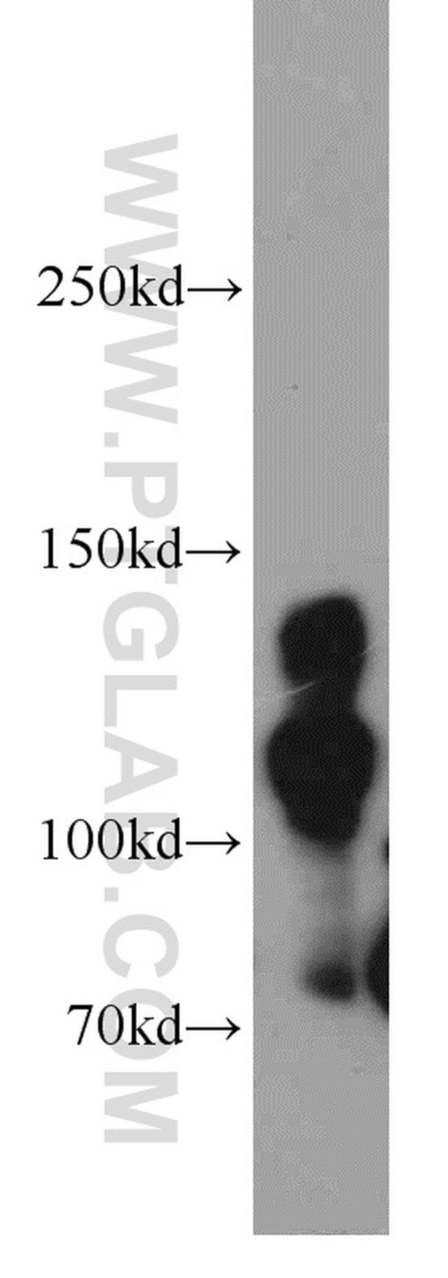 Cingulin Antibody in Western Blot (WB)