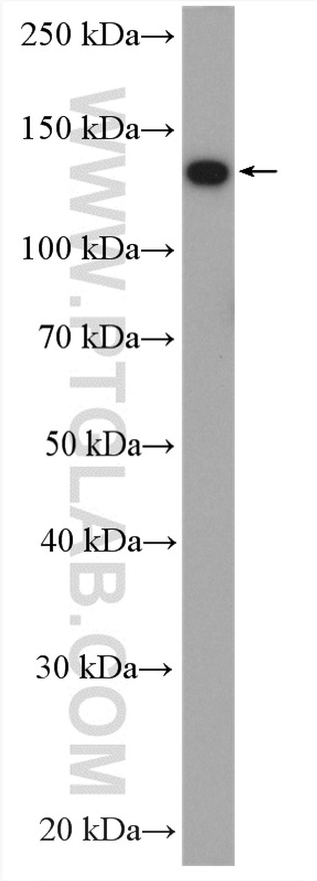 Cingulin Antibody in Western Blot (WB)