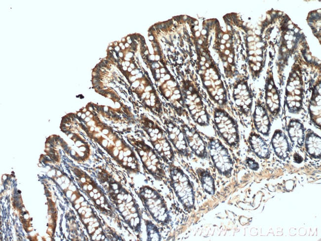 PLCB3 Antibody in Immunohistochemistry (Paraffin) (IHC (P))