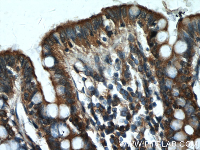 PLCB3 Antibody in Immunohistochemistry (Paraffin) (IHC (P))