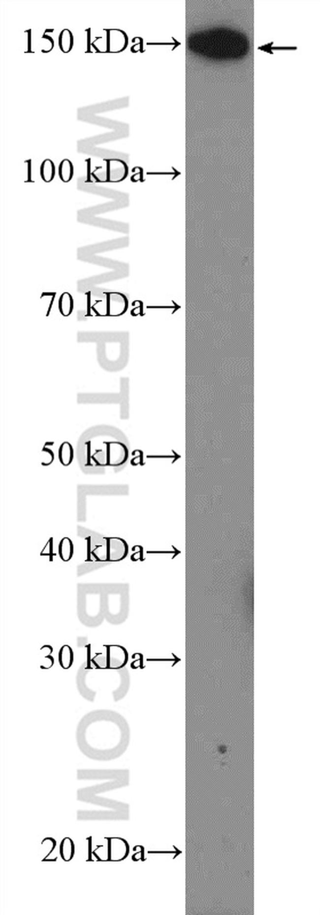 PLCB3 Antibody in Western Blot (WB)