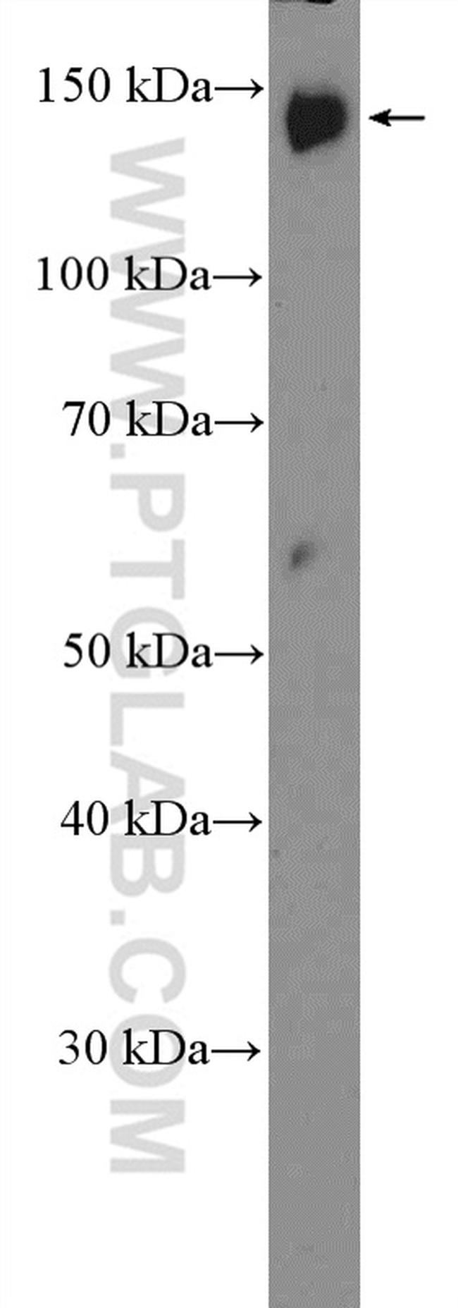 PLCB3 Antibody in Western Blot (WB)