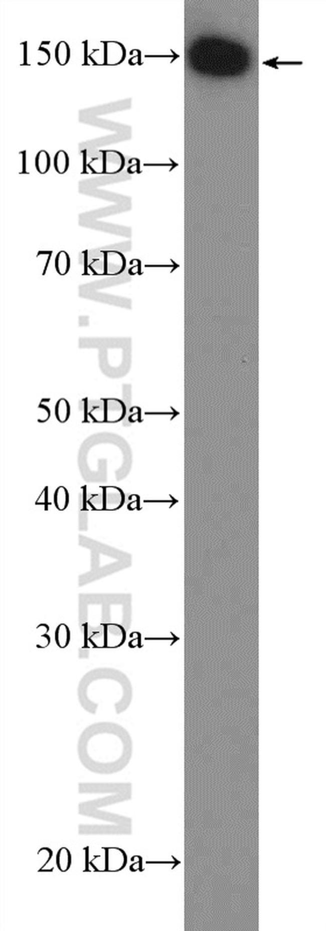 PLCB3 Antibody in Western Blot (WB)