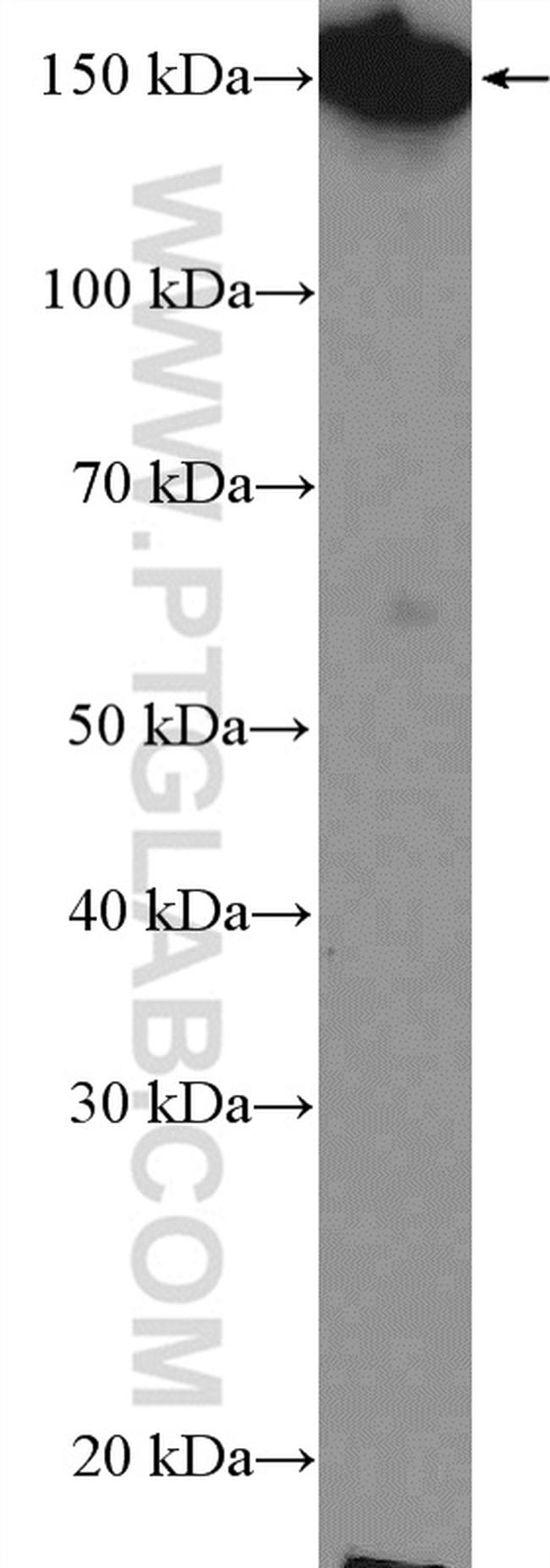 PLCB3 Antibody in Western Blot (WB)