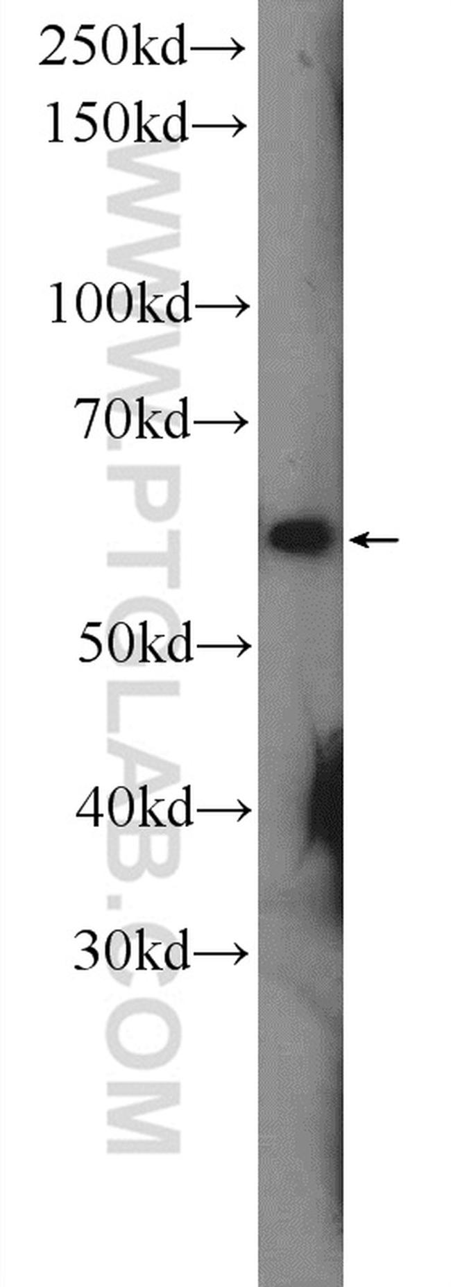 CHRNA7 Antibody in Western Blot (WB)