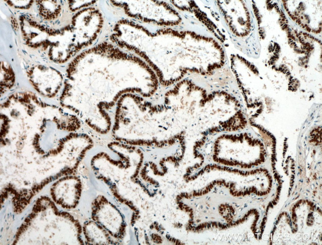 Pan-PAX Antibody in Immunohistochemistry (Paraffin) (IHC (P))