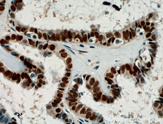 Pan-PAX Antibody in Immunohistochemistry (Paraffin) (IHC (P))