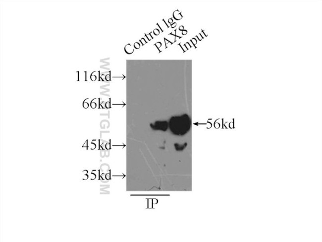 Pan-PAX Antibody in Immunoprecipitation (IP)