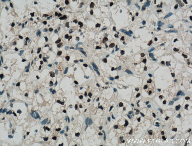 Pan-PAX Antibody in Immunohistochemistry (Paraffin) (IHC (P))