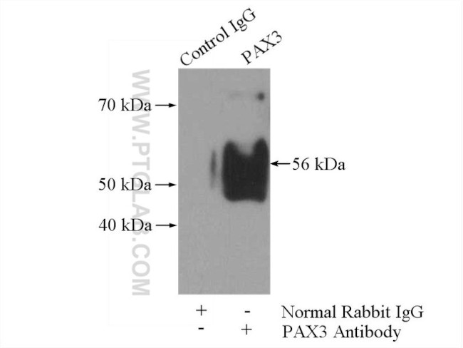 PAX3 Antibody in Immunoprecipitation (IP)