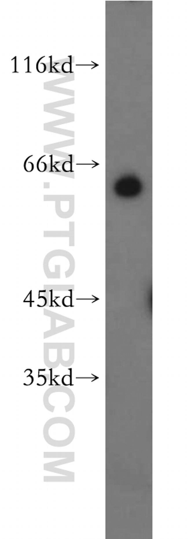 PAX3 Antibody in Western Blot (WB)