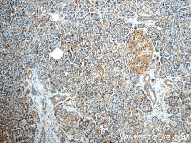 ALDH1L2 Antibody in Immunohistochemistry (Paraffin) (IHC (P))