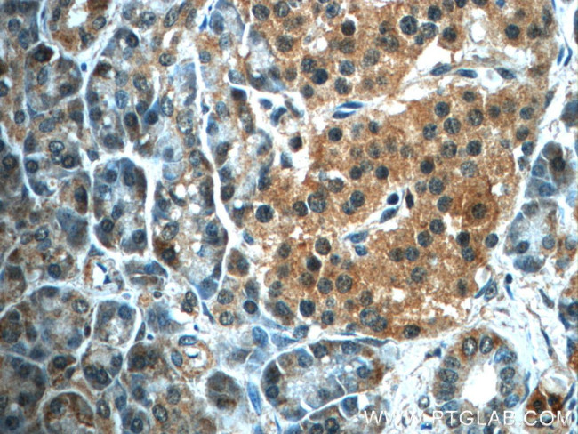 ALDH1L2 Antibody in Immunohistochemistry (Paraffin) (IHC (P))