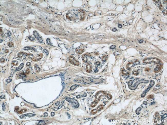 KIAA1602 Antibody in Immunohistochemistry (Paraffin) (IHC (P))