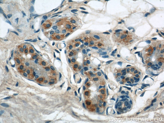 KIAA1602 Antibody in Immunohistochemistry (Paraffin) (IHC (P))