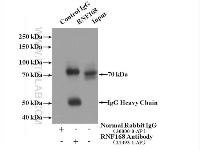 RNF168 Antibody in Immunoprecipitation (IP)