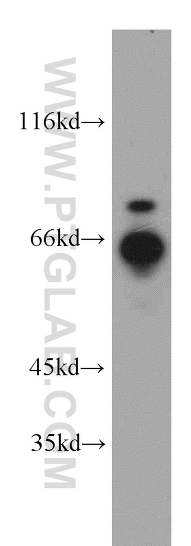 RNF168 Antibody in Western Blot (WB)