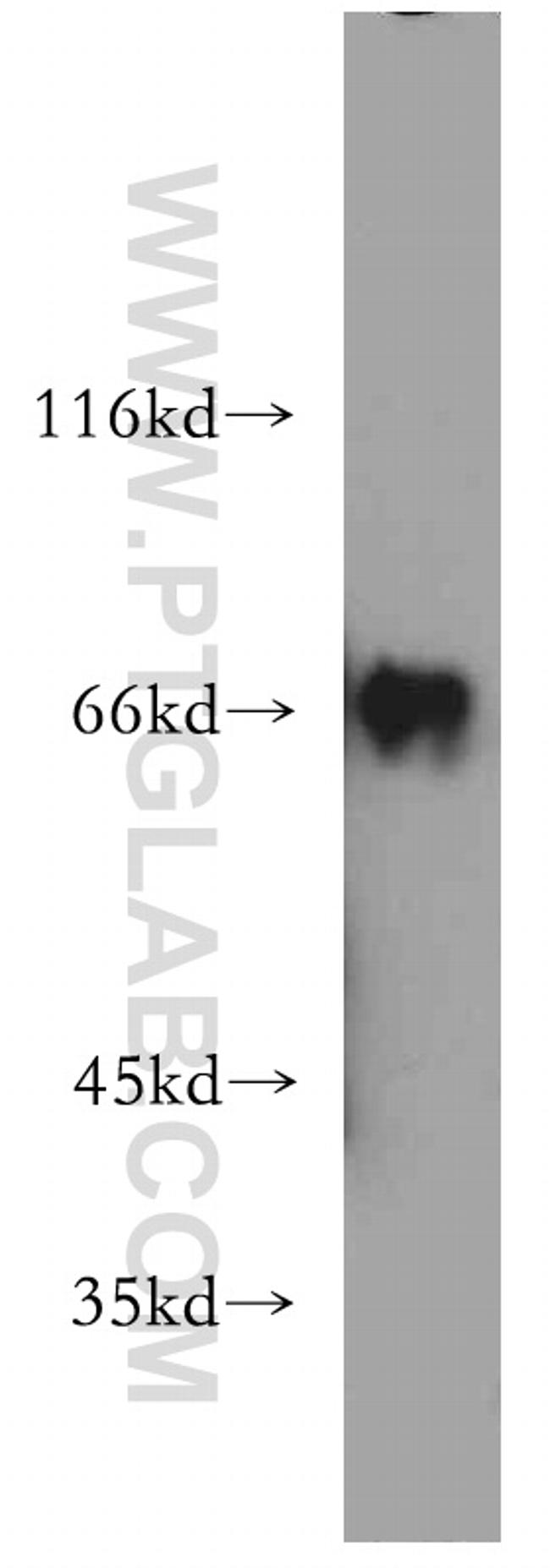 RNF168 Antibody in Western Blot (WB)