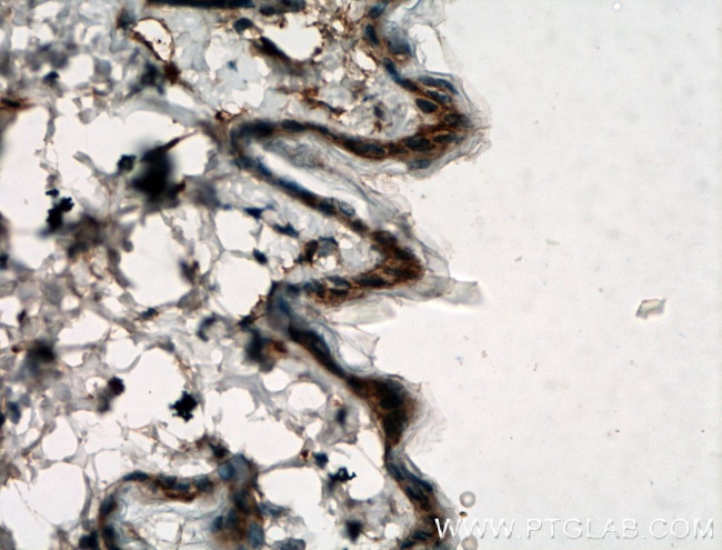 SGSM1 Antibody in Immunohistochemistry (Paraffin) (IHC (P))