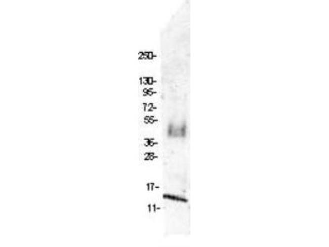 MIP-1 beta Antibody in Western Blot (WB)